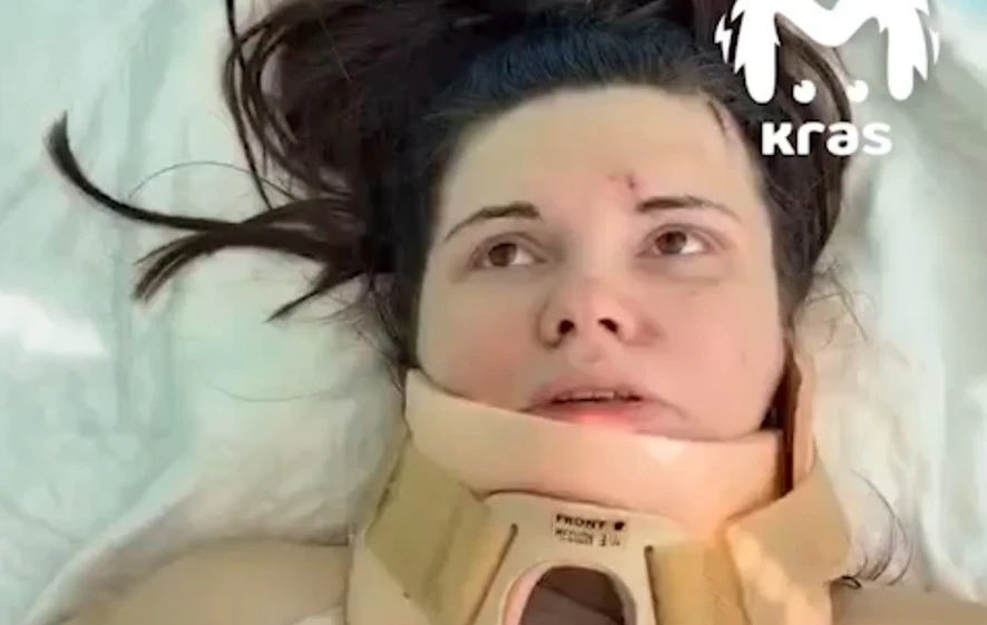 Девушку со сломанным позвоночником экстренно перевели к красноярским хирургам