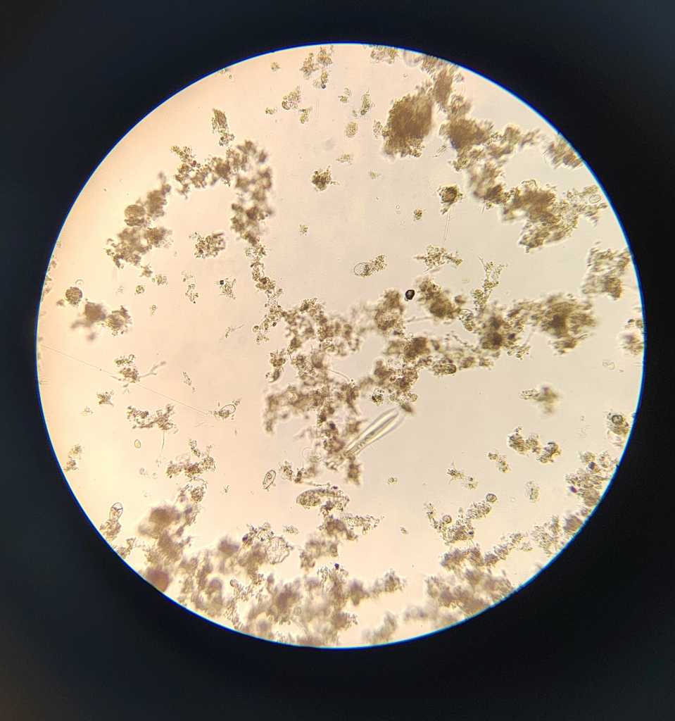 Активный ил очистных сооружений КрасКом под микроскопом.jpg Активный ил очистных сооружений КрасКом под микроскопом.jpg