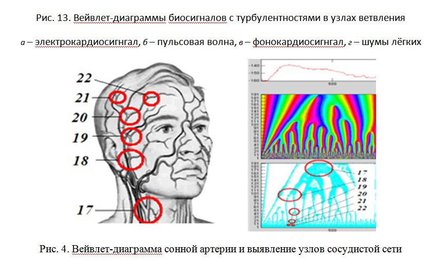 вейвлет.jpg